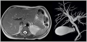 neuro imaging