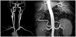 neuro imaging