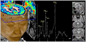neuro imaging