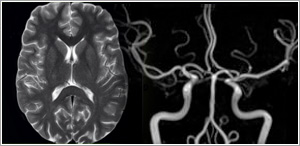 neuro imaging